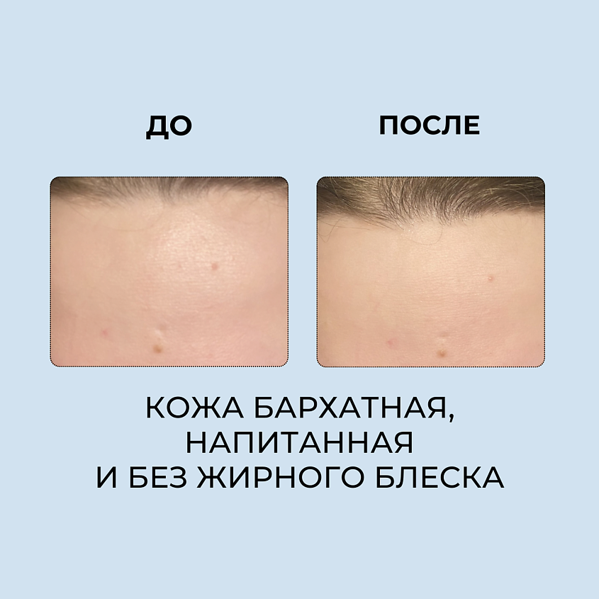 ROUND LAB Мягкий гель для лица 1025 Dokdo Peeling Gel – фото 3