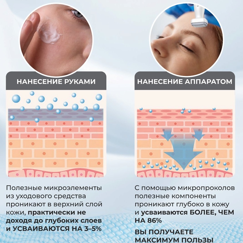 MEZONICA Мезороллер штамп 120 игл с регулируемой длиной 0 - 2 мм – фото 9