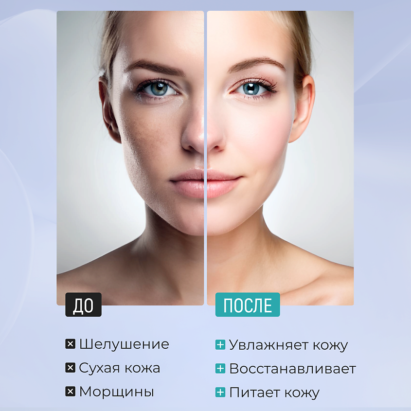 MIVLANE Крем для лица Увлажнение и восстановление с мочевиной – фото 5