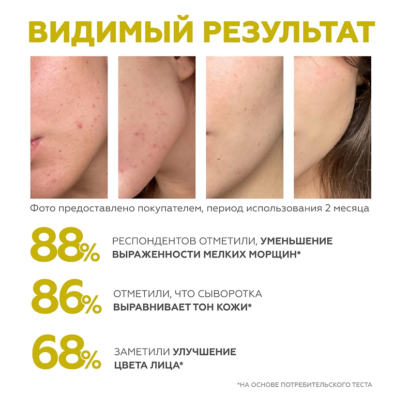 ГЕЛЬТЕК Крем-сыворотка с ретинолом Retiderm 0.25 – фото 7