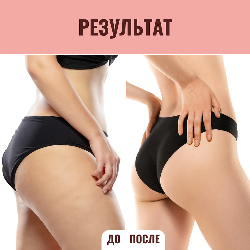 BIOTHAL Интенсивный крем антицеллюлит Intensive Anti Cellulite Body Cream – фото 6