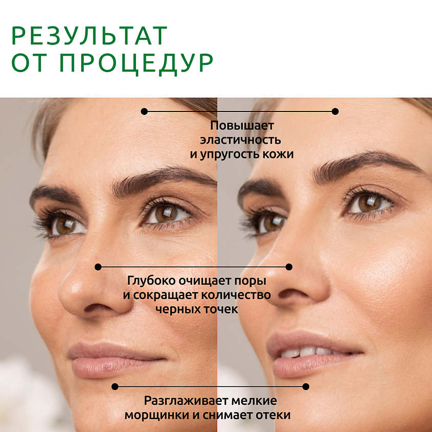 READYSKIN Аппарат для ультразвуковой чистки лица, микротокового лифтинга и массажа Diva – фото 4