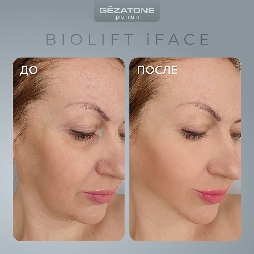 GEZATONE Маска миостимулятор для лица, EMS массажер для лифтинга лица Biolift iFace – фото 8