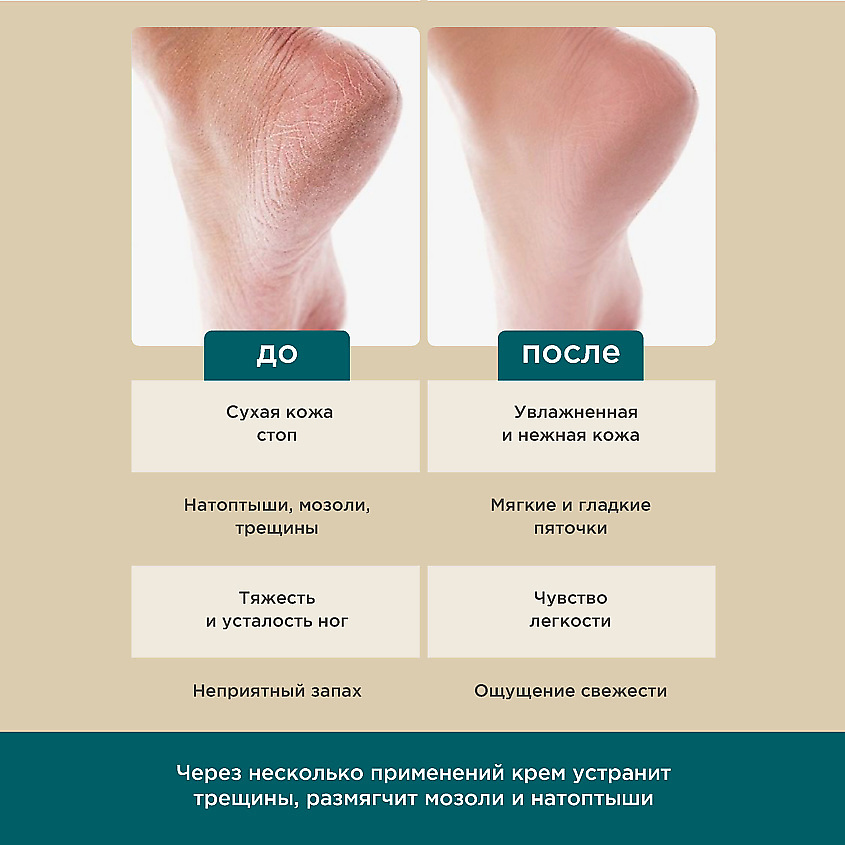 PERFECT4U Активный крем для ног с охлаждающим действием – фото 3