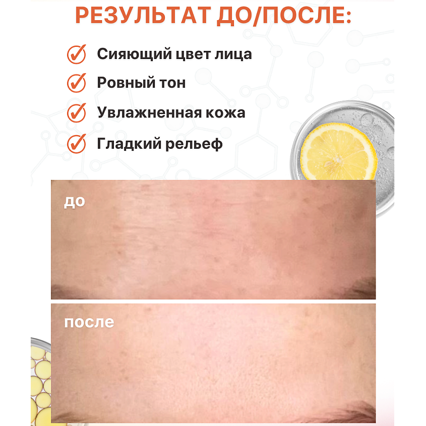 MESOMATRIX Антивозрастная сыворотка с витамином С от морщин VITA-C FERULIC – фото 2