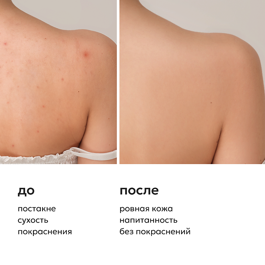 LIKATO Гель для душа уход за проблемной кожей ACNE CONTROL – фото 3