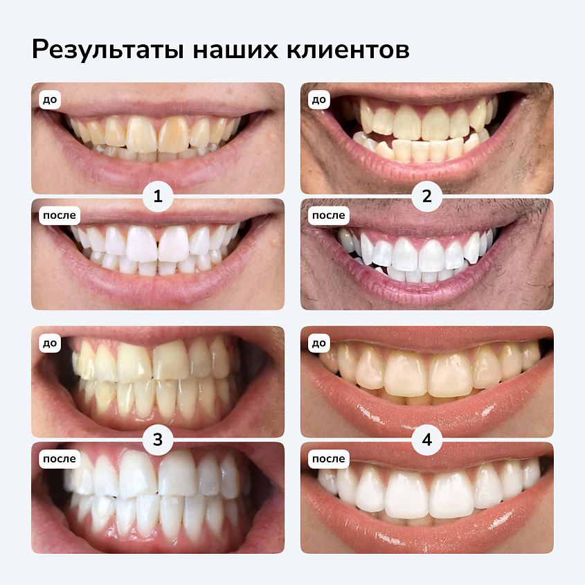 SMILEBE BY TOPLASH Отбеливающие полоски для зубов ProFormula, 28 шт. – фото 5