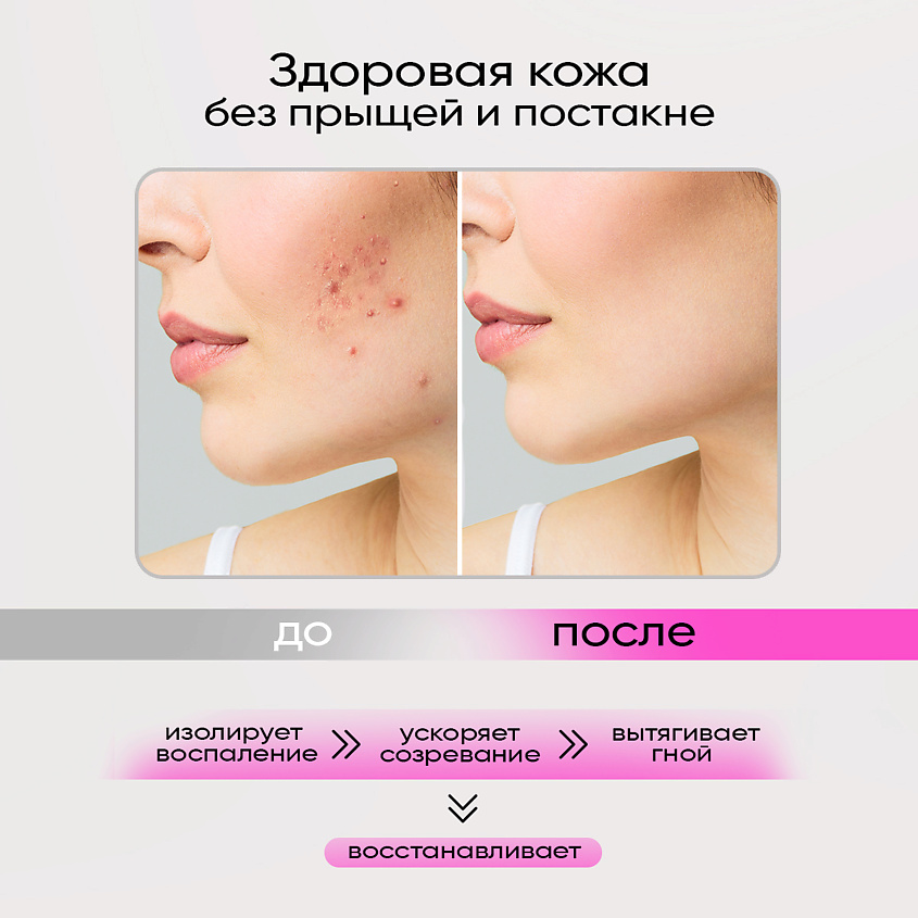 EDEN Патчи от прыщей с салициловой кислотой Stop Acne – фото 2