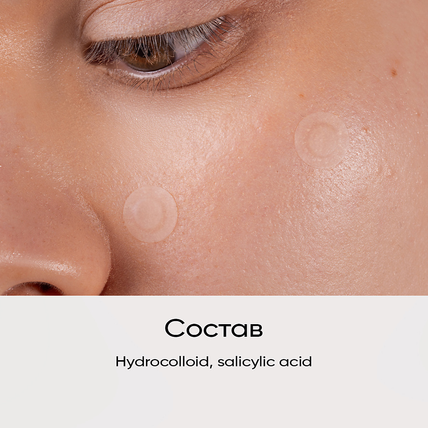 EDEN Патчи от прыщей с салициловой кислотой Stop Acne – фото 7