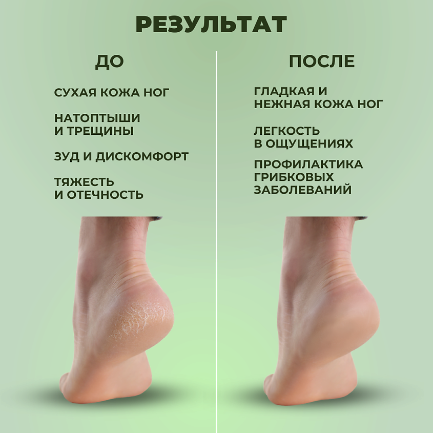 FARMANOVA Для гладких пяток, средство для педикюра с мочевиной, кератолитик – фото 4