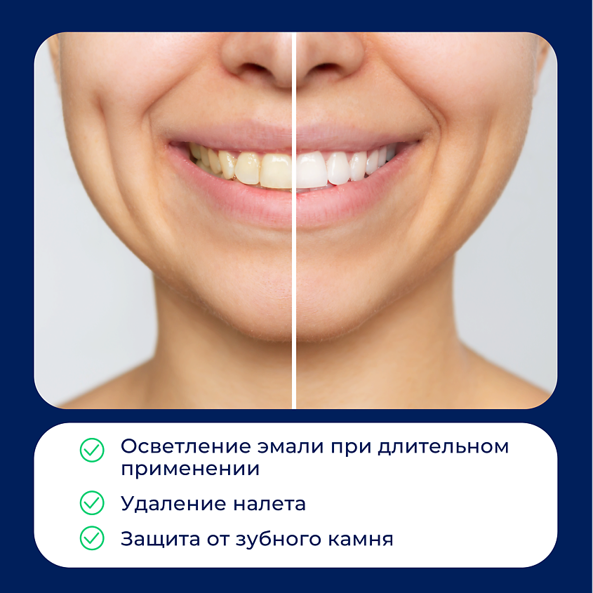 BEIBER Зубная паста отбеливающая Extra White набор – фото 8