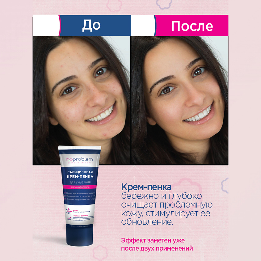 SHESMART Салициловая крем-пенка для умывания Noproblem – фото 5