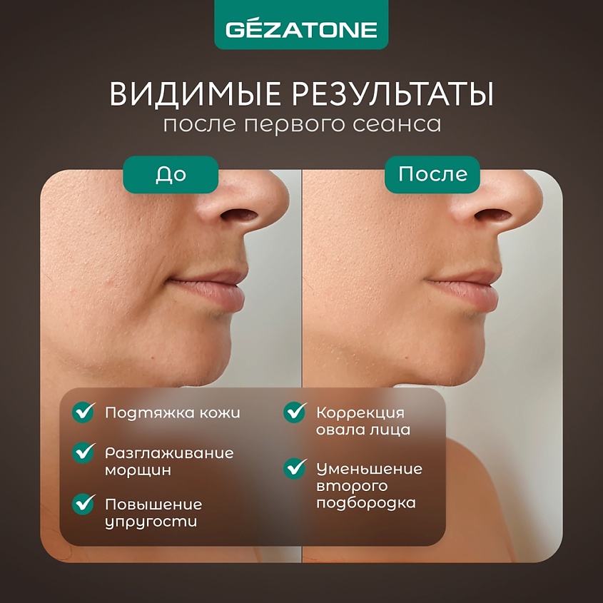 GEZATONE Аппарат для RF-лифтинга, миостимуляции, микротоковой терапии лица, RF-1607 – фото 3