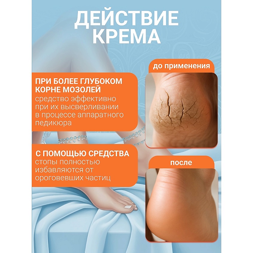 FLORESAN Средство против мозолей KERATODERM – фото 3