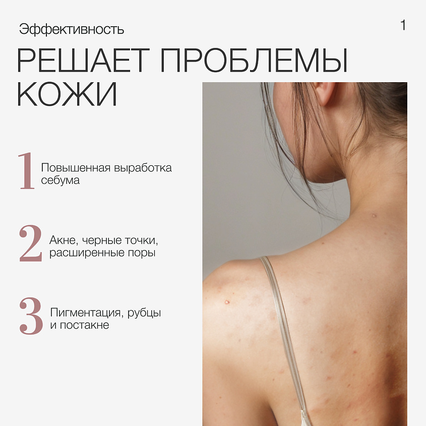 TO MY SKIN Молочко для тела, от прыщей – фото 5