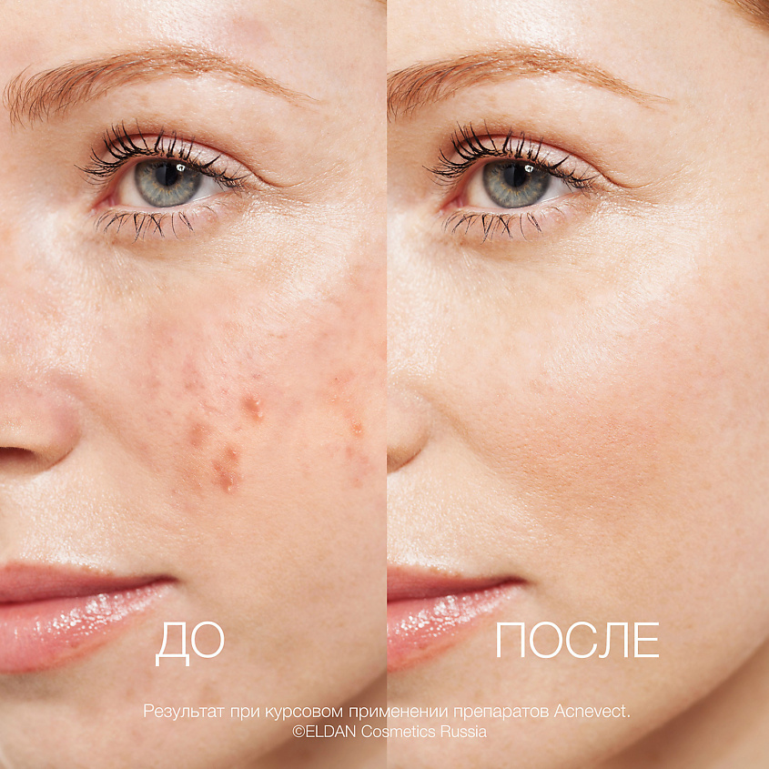 ELDAN COSMETICS Очищающий тоник-лосьон для проблемной кожи – фото 5