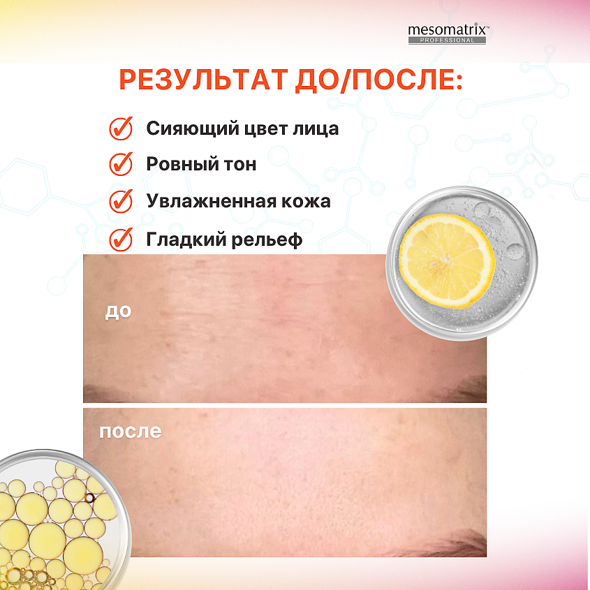 MESOMATRIX Антивозрастной набор для лица с витамином С восстанавливающий (4 в 1) – фото 4