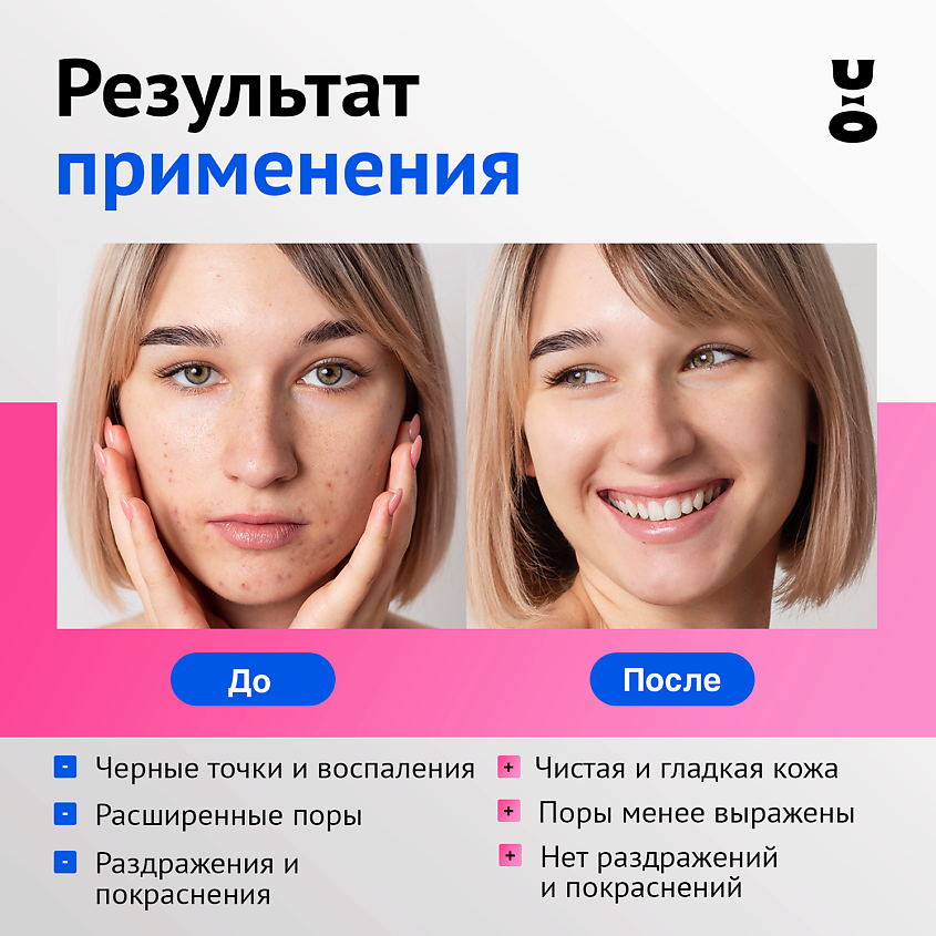 CHA U KAO Энзимная пудра для борьбы с акне ANTIACNE – фото 4