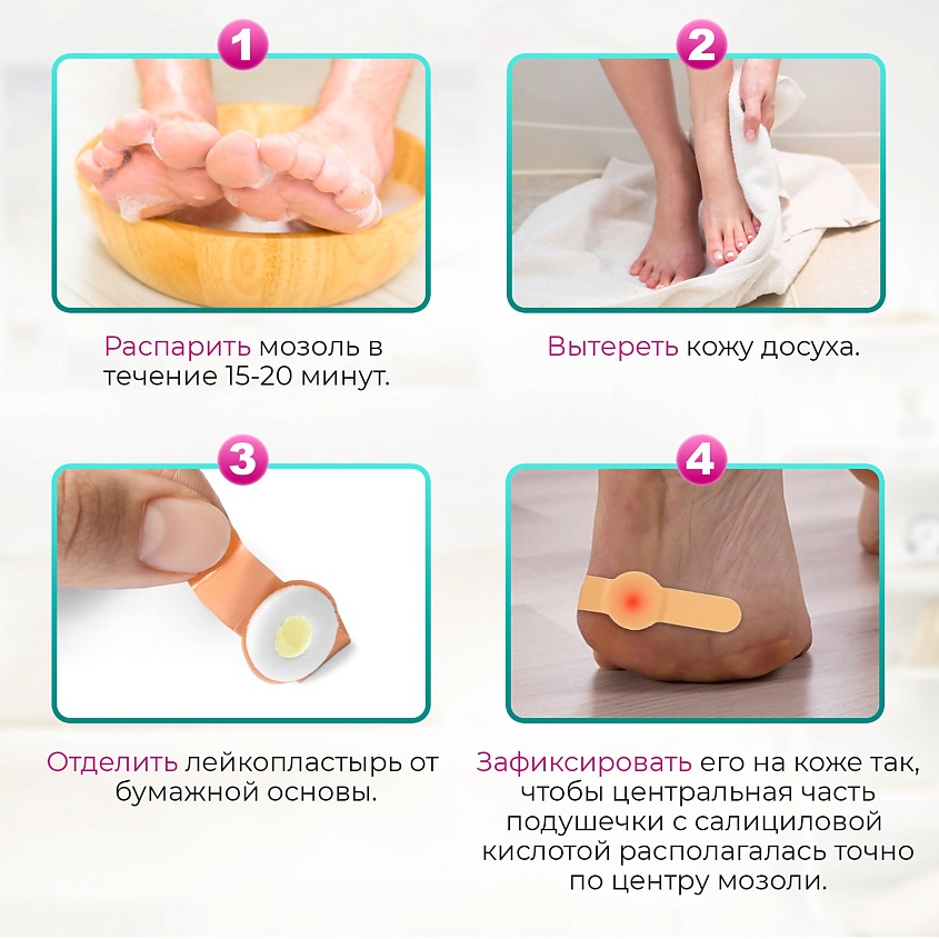 LUXPLAST Лейкопластырь от сухих мозолей на полимерной основе 6 штук – фото 4