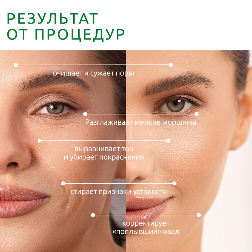 READYSKIN Аппарат Octa для очищения и омоложения кожи 8 в 1 – фото 3