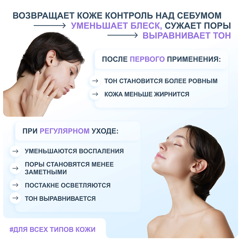 RICHE Сыворотка для лица с ниацинамидом и цинком от прыщей себорегулирующая – фото 2