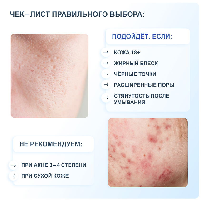 RICHE Крем - пенка для умывания лица увлажняющая – фото 10