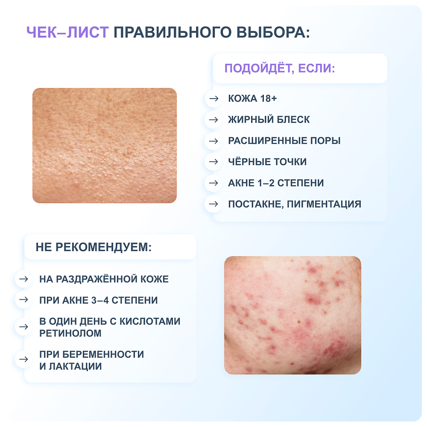 RICHE Сыворотка для лица с ниацинамидом и цинком от прыщей себорегулирующая – фото 12