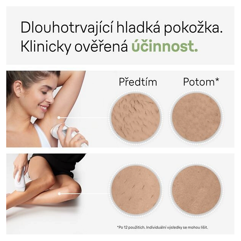 BRAUN Фотоэпилятор Silk-expert Pro 3 IPL PL 3132 + GIL Venus – фото 4