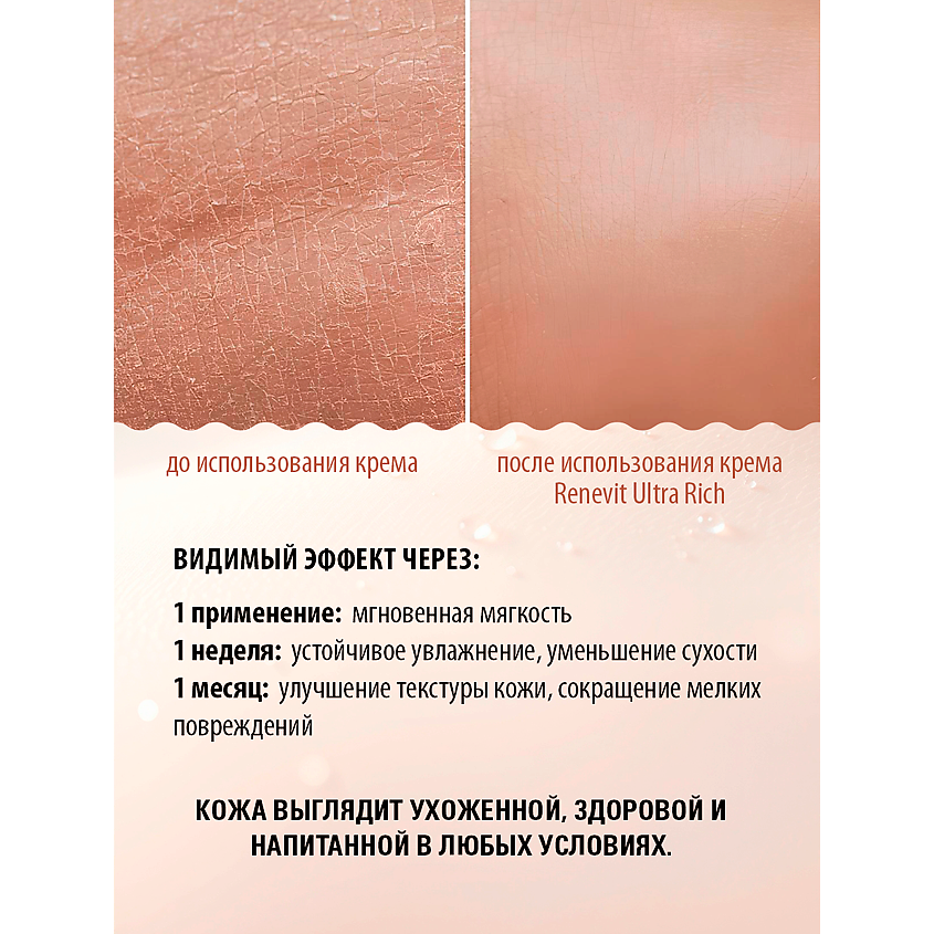 SAFE AND CARE Крем питательный для тела Renevit Ultra Rich – фото 6