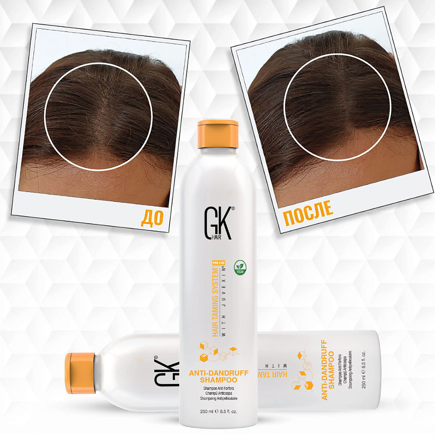 GKHAIR Шампунь Против Перхоти Anti-Dandruff Shampoo – фото 3