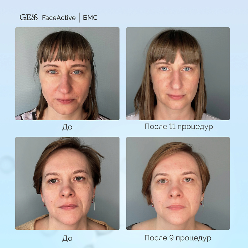 Gess Биомеханический массажер/тренажер для лица Face Active – фото 7