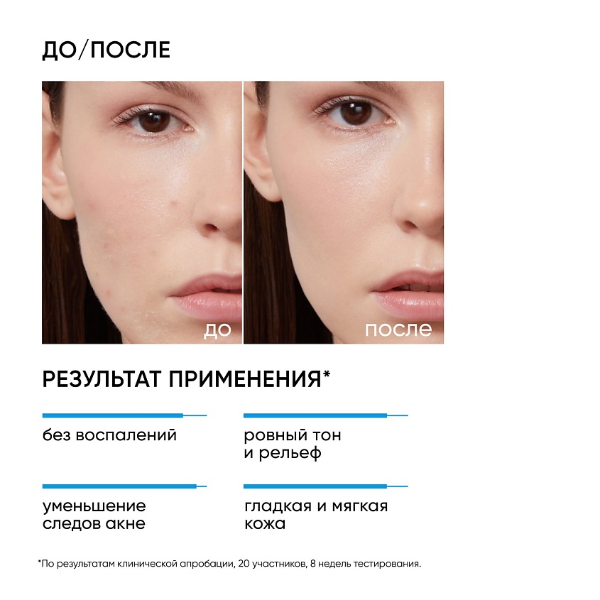 ICON SKIN Пилинг для проблемной кожи 18% – фото 6
