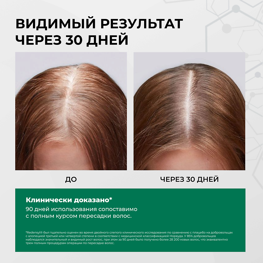 HIPERTIN Набор против выпадения волос Densidyl Prevent+ – фото 3