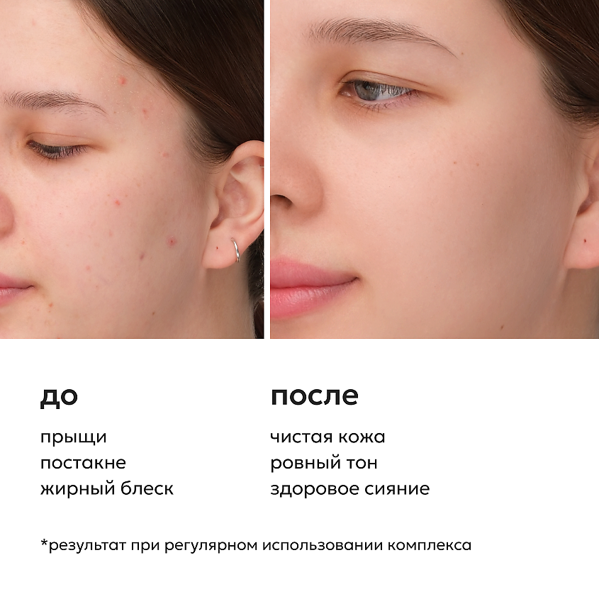 LIKATO Очищающая пенка против жирности кожи и постакне POST ACNE – фото 5