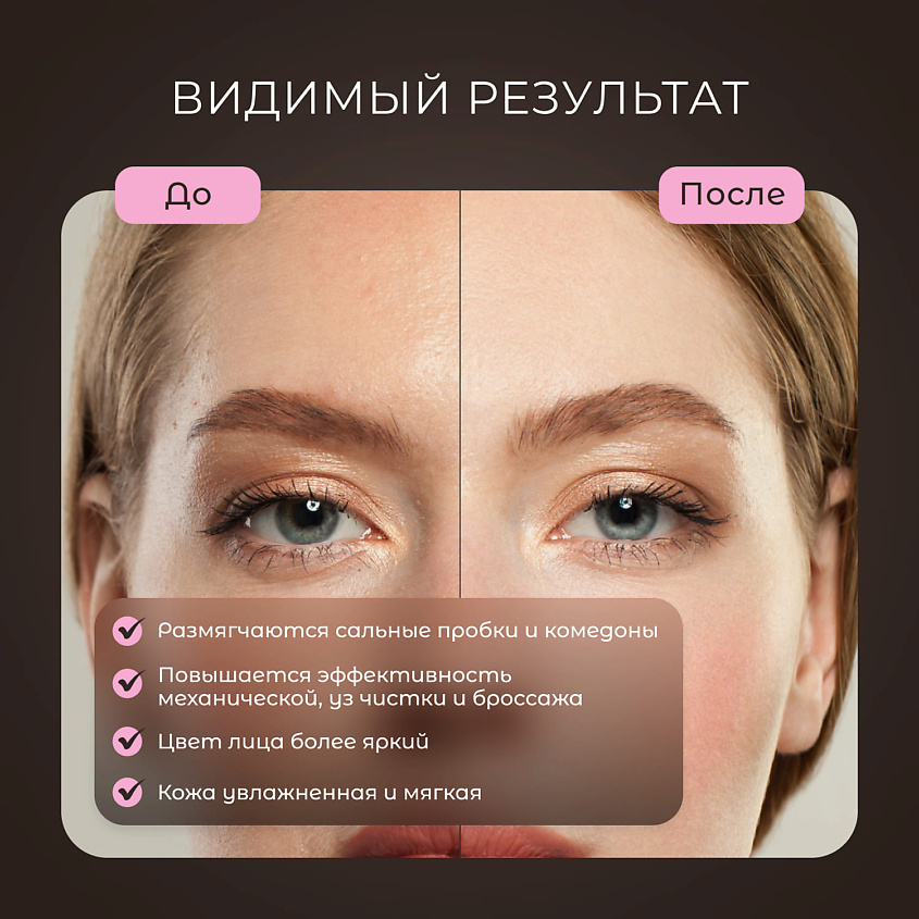 Gezatone Вапоризатор для лица, паровая сауна для распаривания пор 105S – фото 9