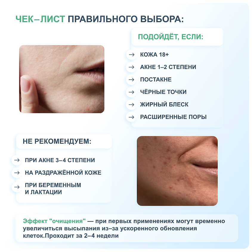 RICHE Тоник для лица с кислотами от прыщей для проблемной кожи – фото 10