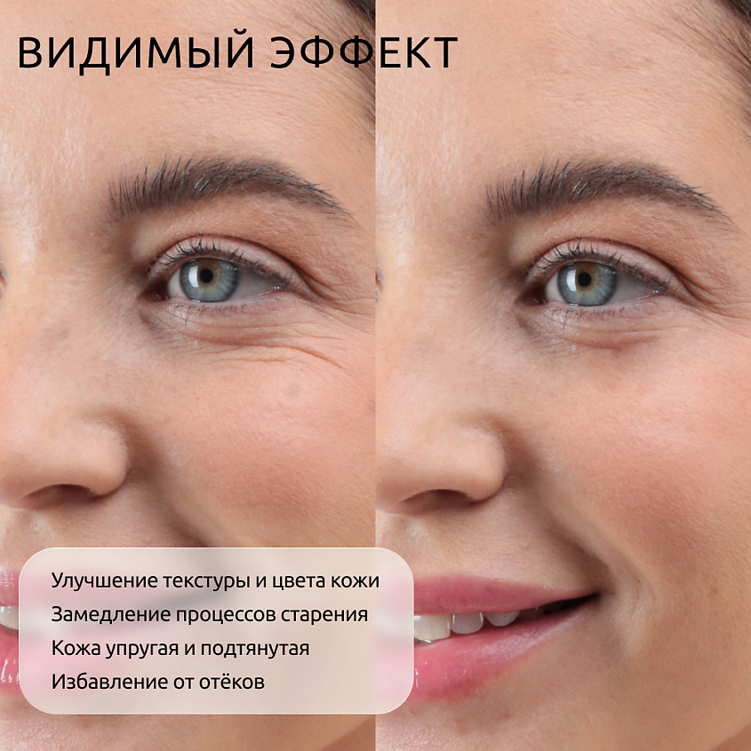 READYSKIN CARE Гель для RF и EMS процедур LIFTING GEL – фото 5