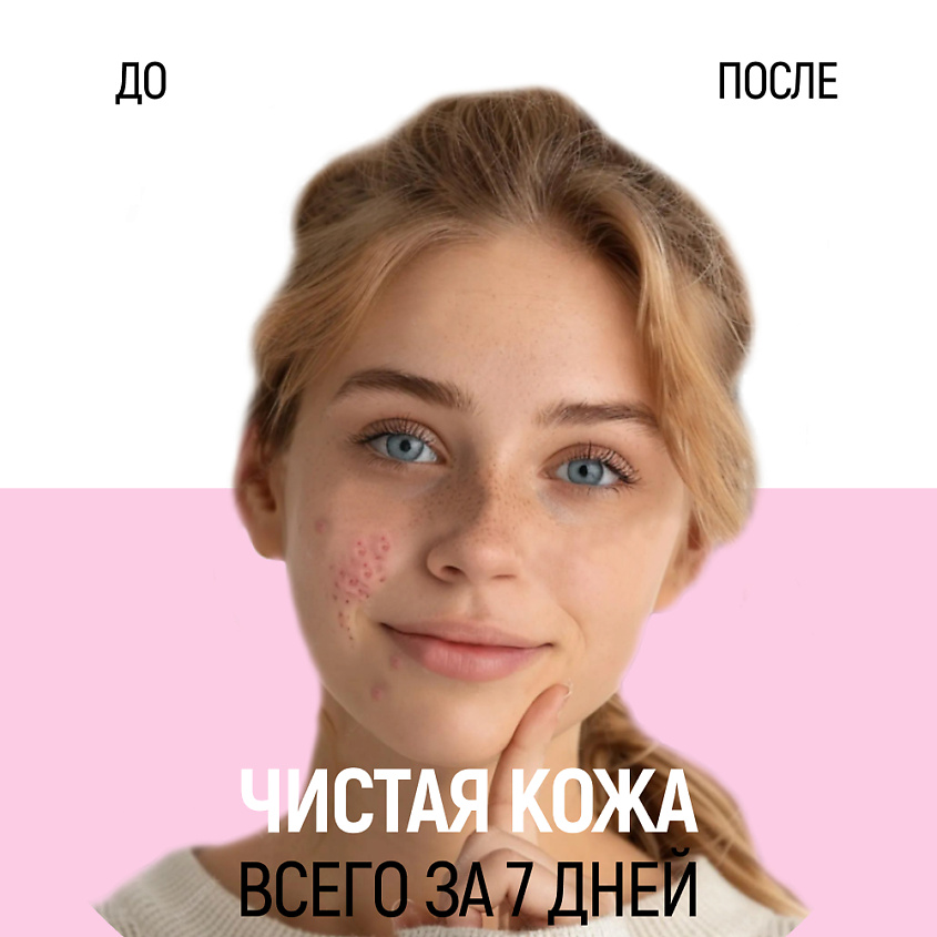 SIBERINA Маска для глубокого очищения кожи лица против прыщей, угрей и чёрных точек с цинком – фото 6