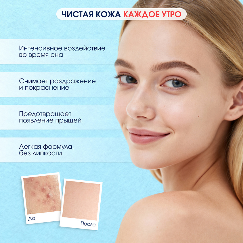 STOPPROBLEM Салициловый ночной экспресс-гель для устранения прыщей – фото 5