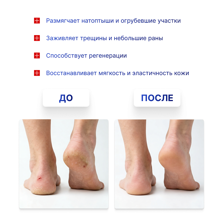 DR. FOOT Паста для удаления натоптышей – фото 2