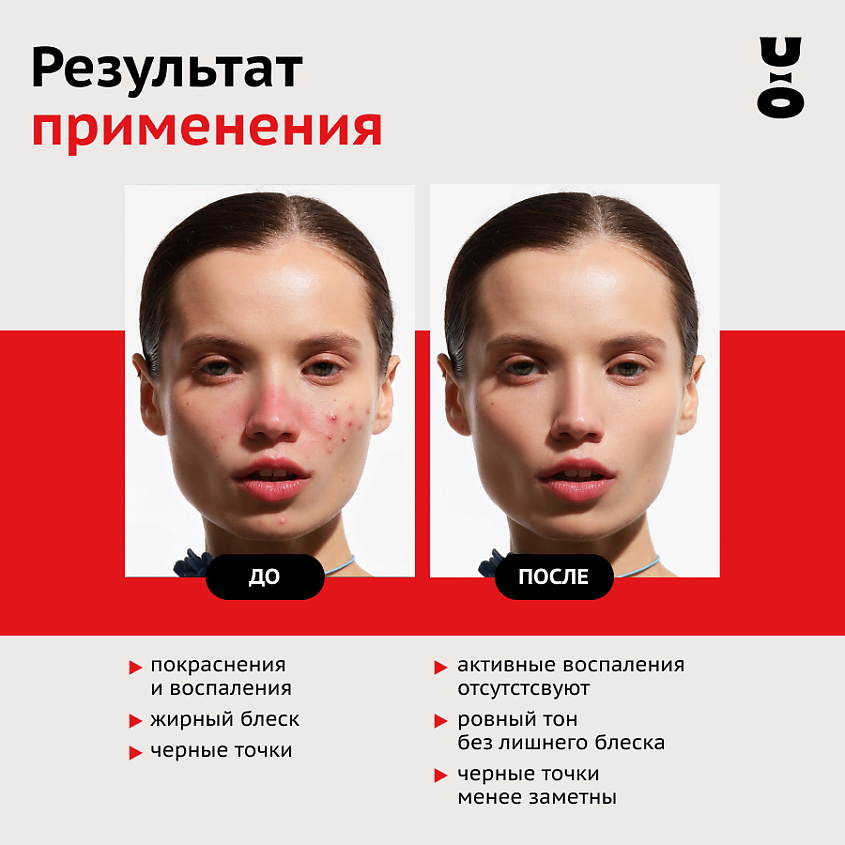 CHA U KAO Себорегулирующий гель для умывания EQUILIBRIST – фото 4