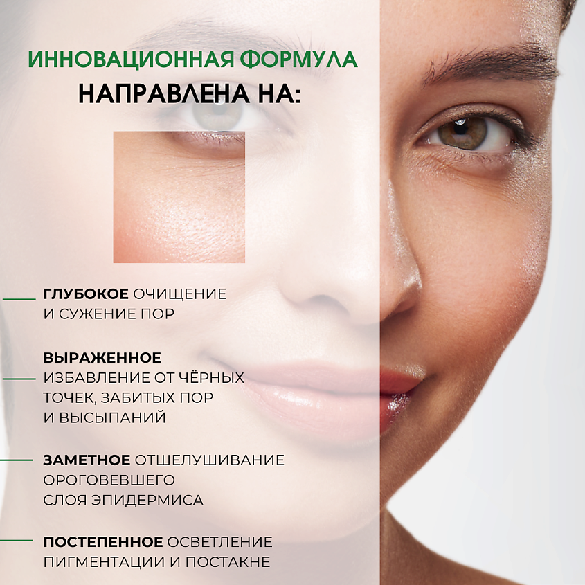 AROCELL Мультикислотные пилинг-пэды Pore Clear Pads – фото 2