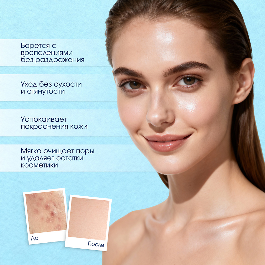 STOPPROBLEM Салициловый лосьон для чувствительной кожи – фото 3