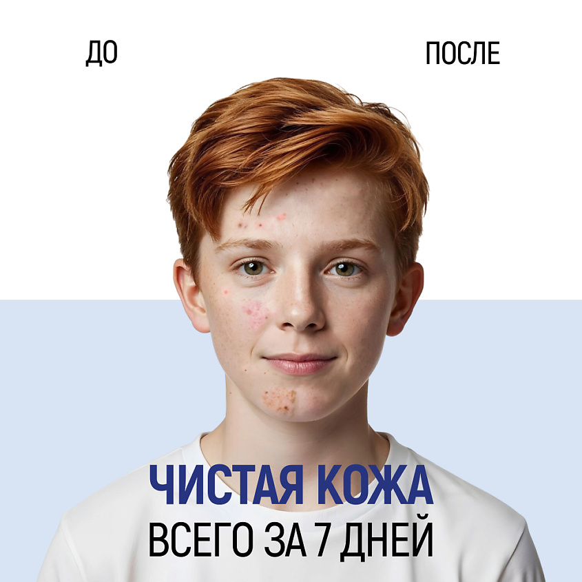 SIBERINA Натуральная фито-пенка для умывания против прыщей, угрей и чёрных точек с цинком – фото 6